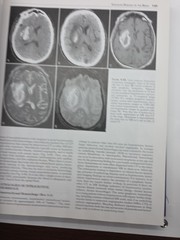 Requisites in Radiology: Neuroradiology by Robert D. Zimmerman, David M. Yousem