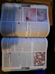 Harrison’s Principles of Internal Medicine (2 volumes)