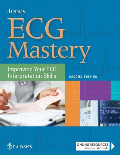 ECG Mastery: Improving Your ECG Interpretation Skills – Paperback – GOOD