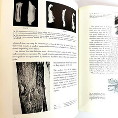 Vintage Surgery of The Facial Nerve Book Hardcover Adolf Michlke 1973