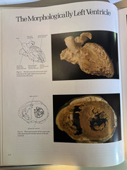 Cardiac Anatomy: An Integrated Text and Color Atlas by Robert Anderson- 1980 -B2