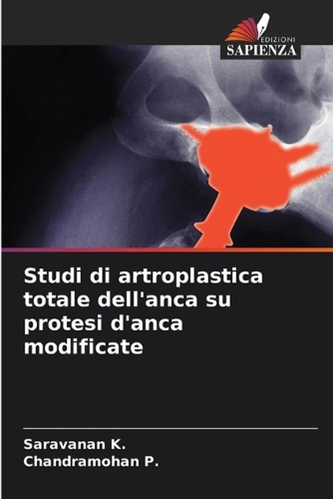 Studi di artroplastica totale dell’anca su protesi d’anca modificate by Saravana