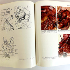Vintage Surgery of The Facial Nerve Book Hardcover Adolf Michlke 1973