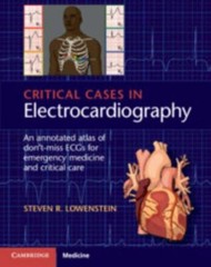 Critical Cases in Electrocardiography: An Annotated Atlas of Don’t-Miss ECGs for