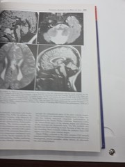 Requisites in Radiology: Neuroradiology by Robert D. Zimmerman, David M. Yousem