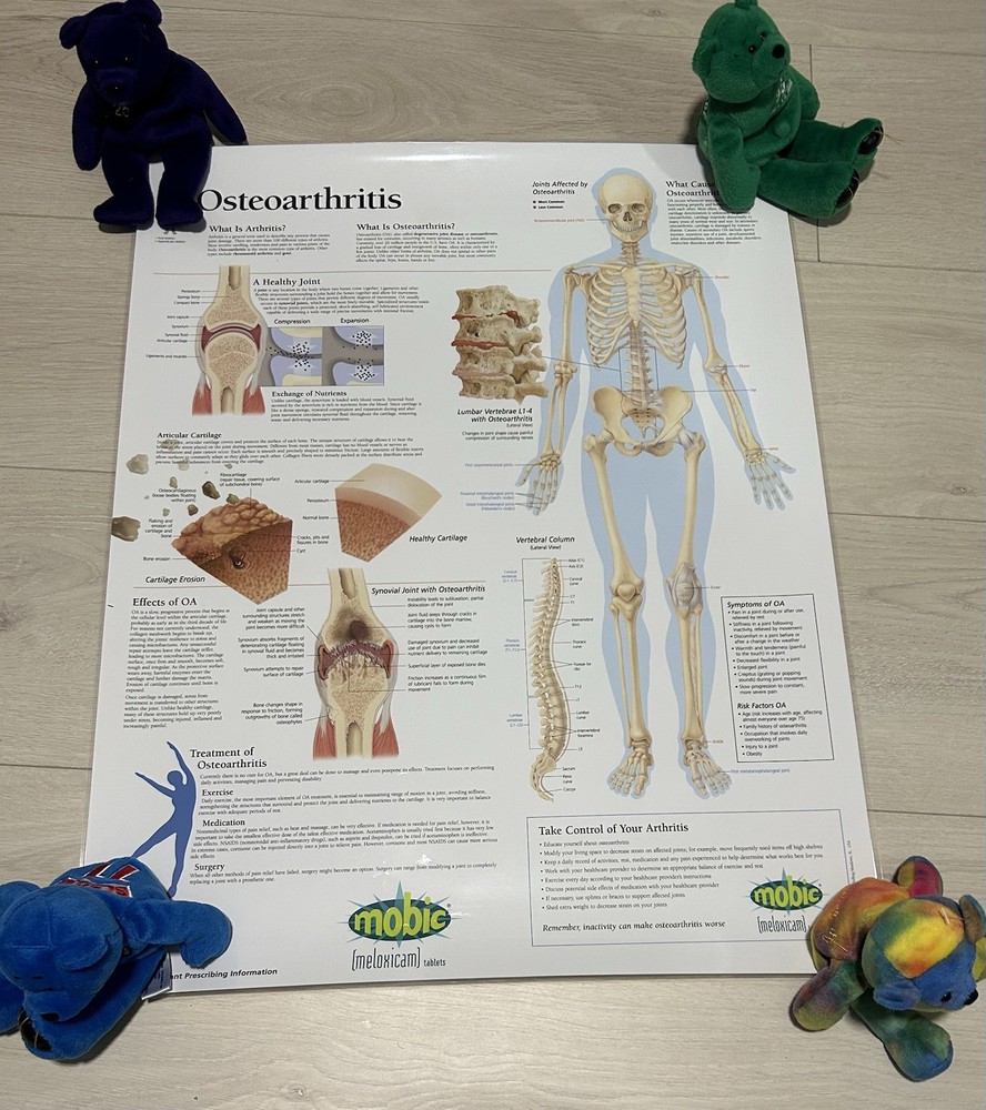 Mobic Osteoarthritis Medical Laminated Diagram 22×28 Educational Poster NIP