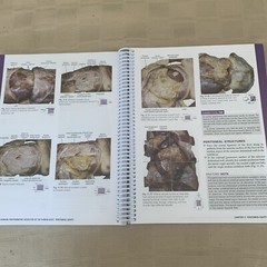 Gray’s Anatomy Ser.: Gray’s Clinical Photographic Dissector of the Human Body by