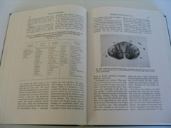 CLINICAL NEUROLOGY BERNARD ALPERS 4TH EDITION 890 PAGES 244 ILLUSTRATIONS HB