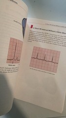The Only EKG Book You’ll Ever Need Ninth Edition