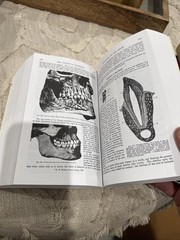 Gray’s Anatomy Unabridged Running Press Edition Hardcover 827 Illustrations