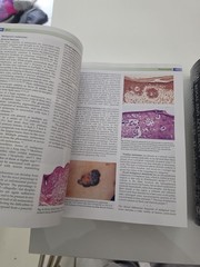 Rosai and Ackerman’s Surgical Pathology (2 Vol Set) 9th Ed HC 2004 VG- cond.