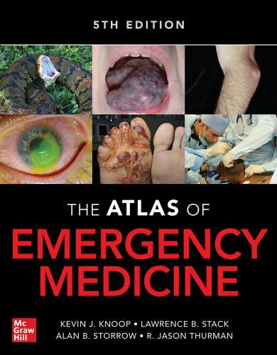Atlas of Emergency Medicine 5th Edition, Knoop, Kevin J.,Stack, Lawrence B.,Stor