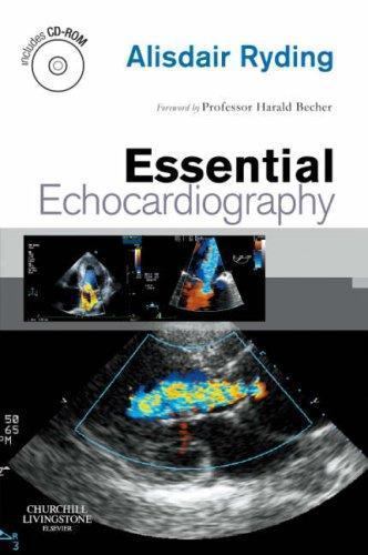 Essential Echocardiography