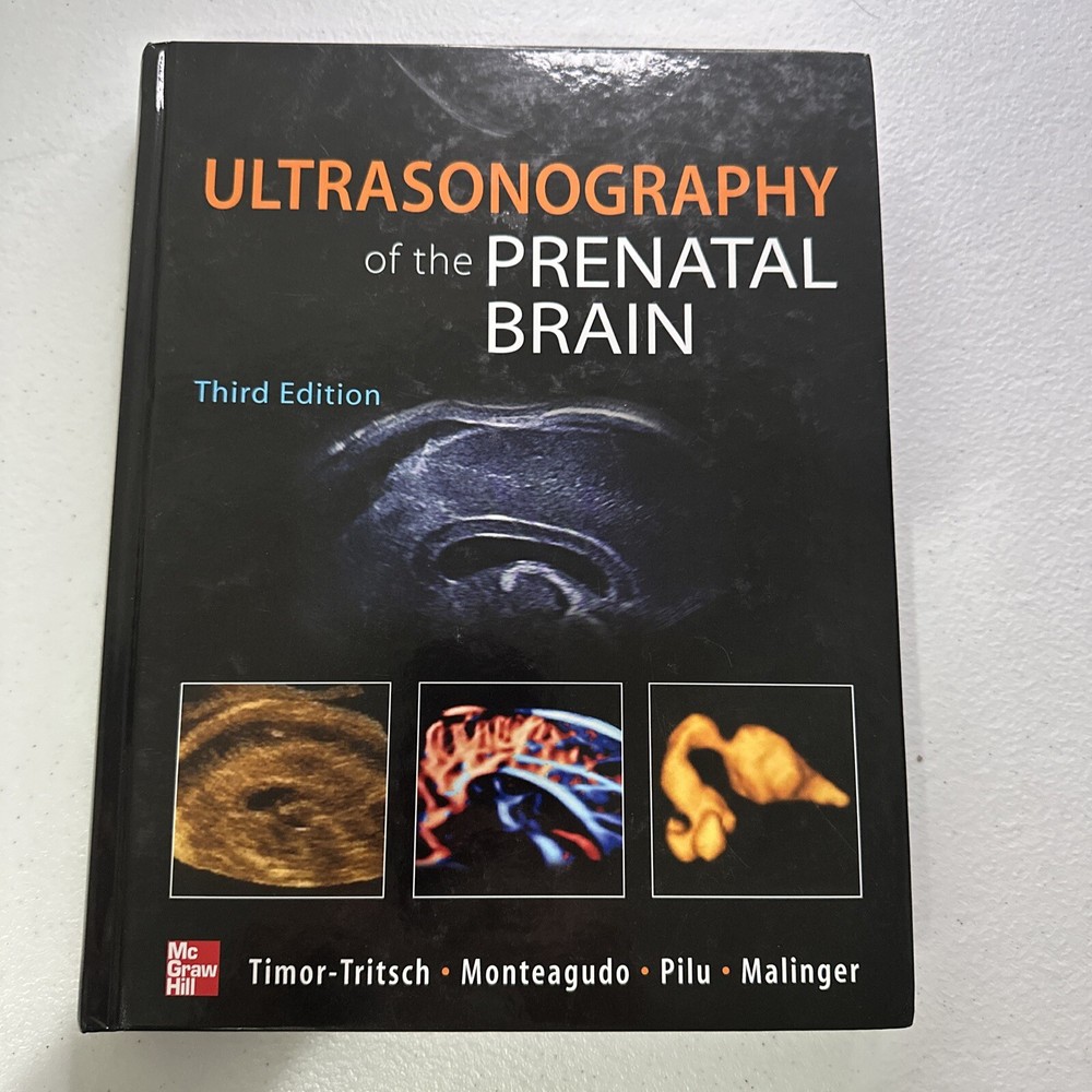 Ultrasonography of the Prenatal Brain, Third Edition by Ana Monteagudo, Ilan…