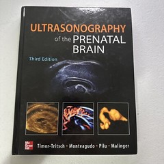 Ultrasonography of the Prenatal Brain, Third Edition by Ana Monteagudo, Ilan…