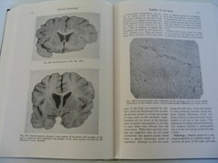 CLINICAL NEUROLOGY BERNARD ALPERS 4TH EDITION 890 PAGES 244 ILLUSTRATIONS HB