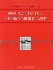 Pearls & Pitfalls in Electrocardiography : Pithy, Practical Pointers
